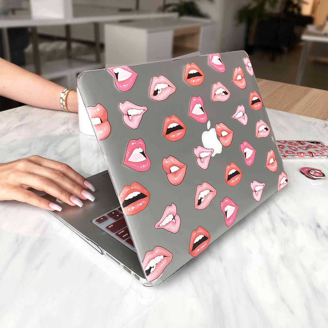 Nude Lips MacBook Case - Image 2
