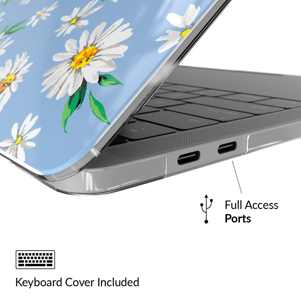 Blue Daisy MacBook Case - Image 4