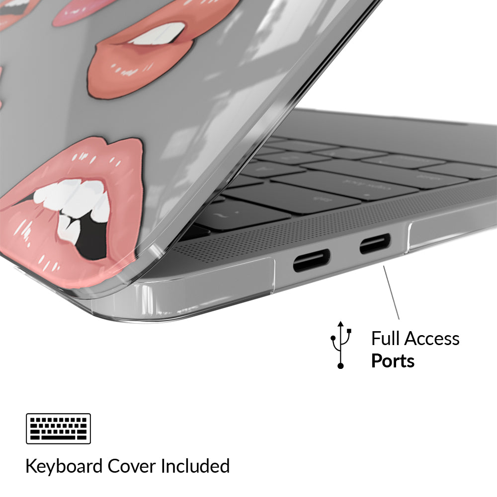 Nude Lips MacBook Case - Image 4