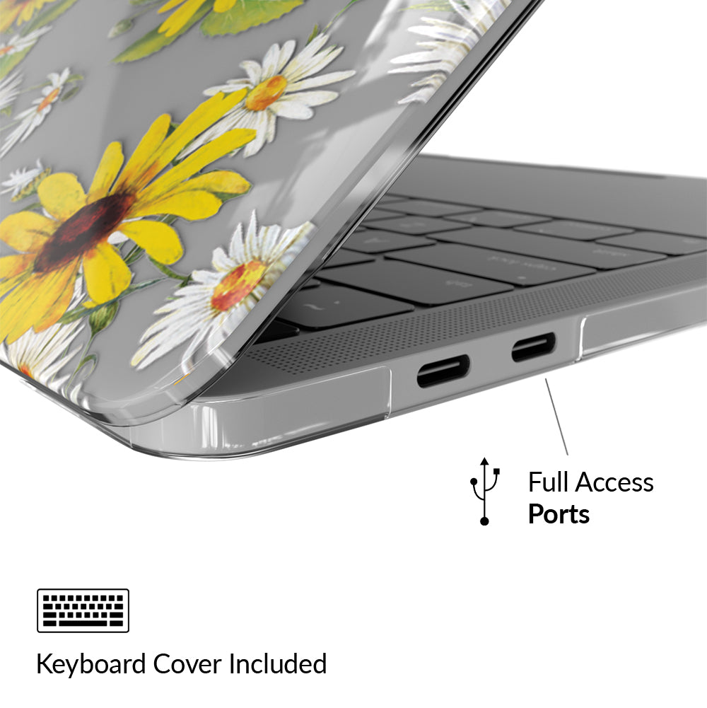 Sunflower MacBook Case - Image 4