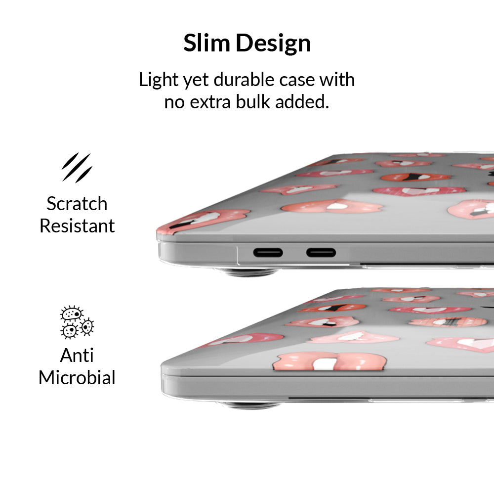 Nude Lips MacBook Case - Image 5