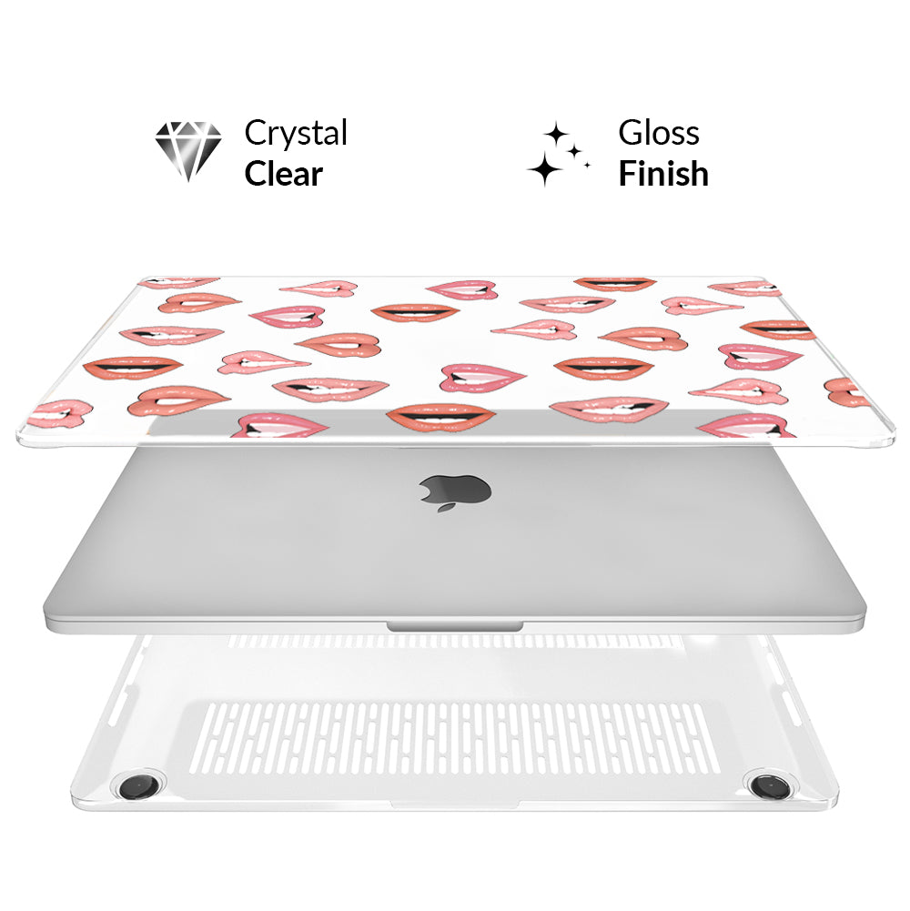 Nude Lips MacBook Case - Image 3